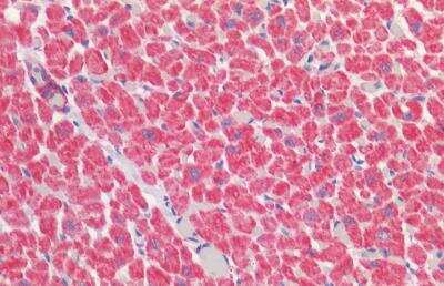 Immunohistochemistry-Paraffin: VDAC2 Antibody [NBP3-12109]