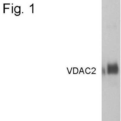 Western Blot: VDAC2 Antibody [NB100-74560]