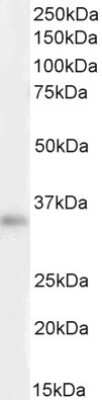 Western Blot: VDAC2 Antibody [NB300-871]