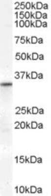 Western Blot: VDAC2 Antibody [NBP1-68794]