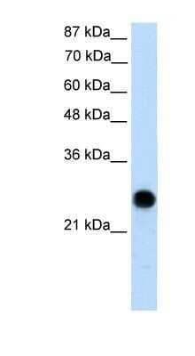 Western Blot: VDAC2 Antibody [NBP1-80065]