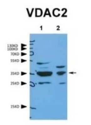 Western Blot: VDAC2 Antibody [NBP1-80065]