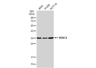 Western Blot: VDAC2 Antibody [NBP2-20849]