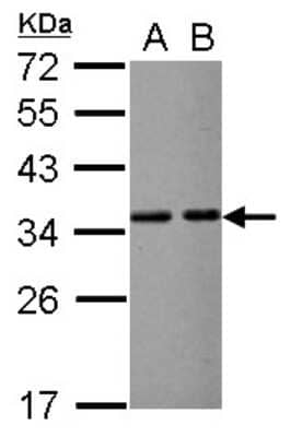 Western Blot: VDAC2 Antibody [NBP2-20850]