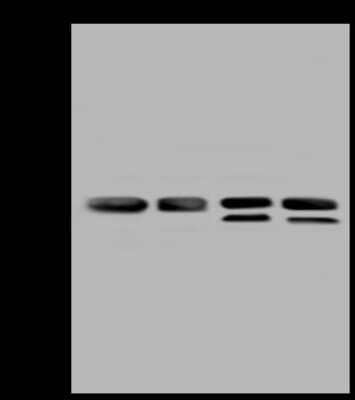 Western Blot: VDAC2 Antibody [NBP2-97576]