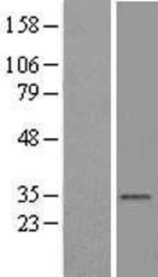 Western Blot: VDAC2 Overexpression Lysate [NBL1-17709]