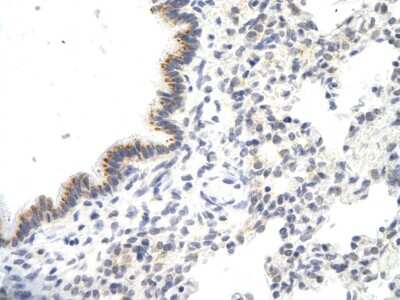 Immunohistochemistry: VDAC3 Antibody [NBP1-80070]