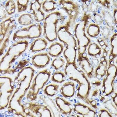 Immunohistochemistry-Paraffin: VDAC3 Antibody - Azide and BSA Free [NBP2-94176]