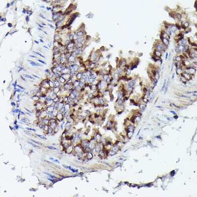 Immunohistochemistry-Paraffin: VDAC3 Antibody - Azide and BSA Free [NBP2-94176]
