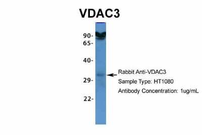 Western Blot: VDAC3 Antibody [NBP1-80069]