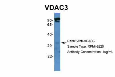 Western Blot: VDAC3 Antibody [NBP1-80069]