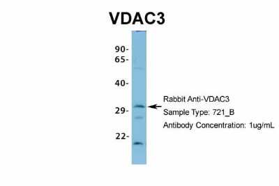 Western Blot: VDAC3 Antibody [NBP1-80070]