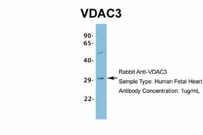 Western Blot: VDAC3 Antibody [NBP1-80070]