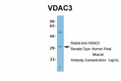 Western Blot: VDAC3 Antibody [NBP1-80070]