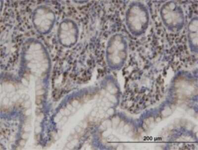 Immunohistochemistry-Paraffin: VDP p115 Antibody (3F4) [H00008615-M03]