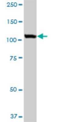 Western Blot: VDP p115 Antibody (3F4) [H00008615-M03]