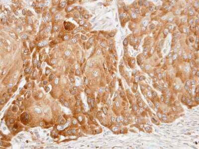 Immunohistochemistry-Paraffin: VDP p115 Antibody [NBP2-20851]