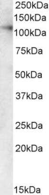 Western Blot: VDP p115 Antibody [NB100-2430]