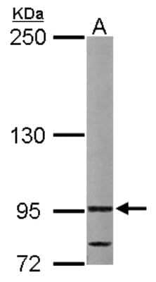 Western Blot: VDP p115 Antibody [NBP2-17245]