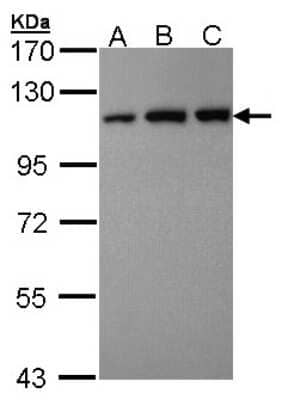 Western Blot: VDP p115 Antibody [NBP2-20851]