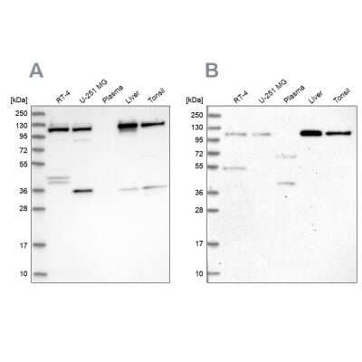 Western Blot: VDP p115 Antibody [NBP2-38401]