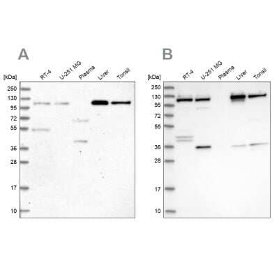 Western Blot: VDP p115 Antibody [NBP2-55590]