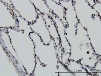 Immunohistochemistry-Paraffin: VDR/NR1I1/Vitamin D Receptor Antibody (2F4) [H00007421-M02]