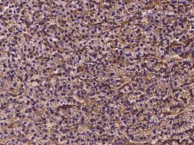 Immunohistochemistry-Paraffin: VDR/NR1I1/Vitamin D Receptor Antibody [NBP2-98840]