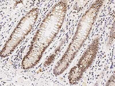 Immunohistochemistry-Paraffin: VDR/NR1I1/Vitamin D Receptor Antibody [NBP2-98841]