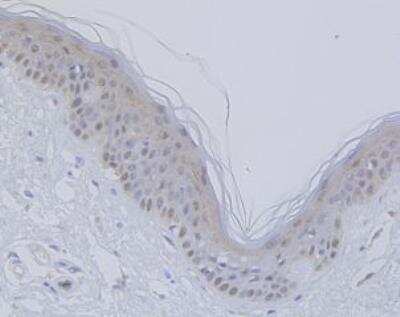 Immunohistochemistry-Paraffin: VDR/NR1I1/Vitamin D Receptor Antibody (JA11-16) [NBP2-66778]