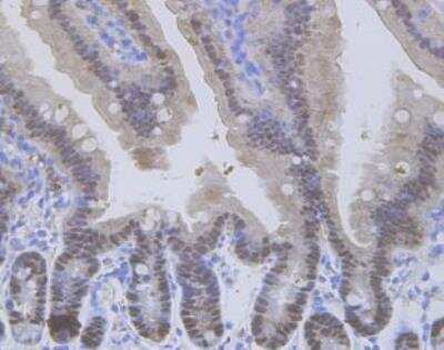 Immunohistochemistry-Paraffin: VDR/NR1I1/Vitamin D Receptor Antibody (JA11-16) [NBP2-66778]