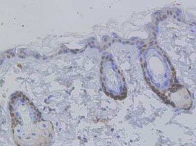 Immunohistochemistry-Paraffin: VDR/NR1I1/Vitamin D Receptor Antibody (JA11-16) [NBP2-66778]