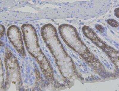 Immunohistochemistry-Paraffin: VDR/NR1I1/Vitamin D Receptor Antibody (JA11-16) [NBP2-66778]