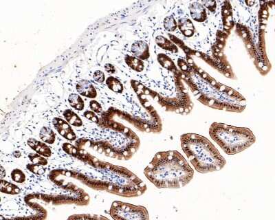 Immunohistochemistry-Paraffin: VDR/NR1I1/Vitamin D Receptor Antibody (JA11-16) [NBP2-66778]