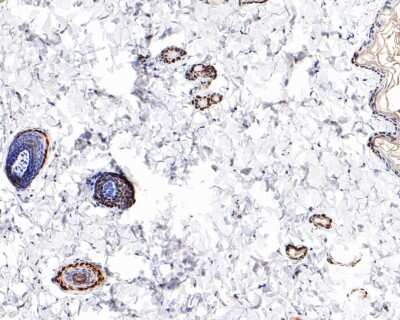 Immunohistochemistry-Paraffin: VDR/NR1I1/Vitamin D Receptor Antibody (JA11-16) [NBP2-66778]