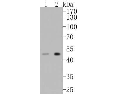 Western Blot: VDR/NR1I1/Vitamin D Receptor Antibody (JA11-16) [NBP2-66778]