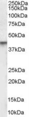 Western Blot: VDR/NR1I1/Vitamin D Receptor Antibody [NB600-794]