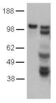 Western Blot: VE-Cadherin Antibody (16B1) [NBP2-00342]