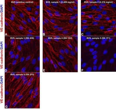 Immunocytochemistry/ Immunofluorescence: VE-Cadherin Antibody (BV9) [NB600-1409]