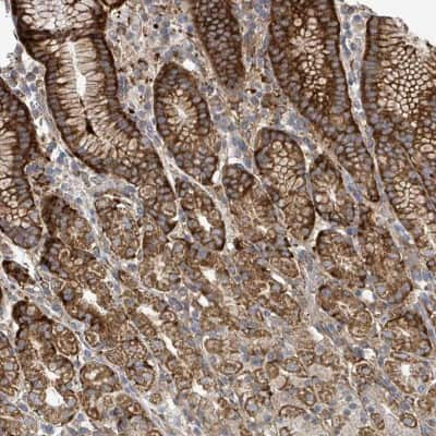 Immunohistochemistry: VE-Statin/EGFL7 Antibody [NBP2-68693]