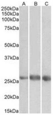 Western Blot: VE-Statin/EGFL7 Antibody [NBP2-44320]