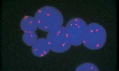 In-situ Hybridization: VECTASHIELD(R) Antifade Mounting Medium with DAPI [H-1200-NB]