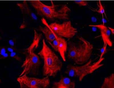 Immunocytochemistry/ Immunofluorescence: VECTASHIELD(R) HardSet(TM) Antifade Mounting Medium with DAPI [H-1500-NB]