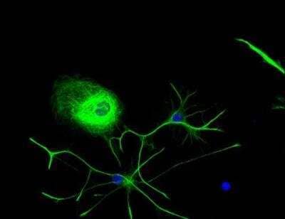 Immunocytochemistry/ Immunofluorescence: VECTASHIELD(R) HardSet(TM) Antifade Mounting Medium with DAPI [H-1500-NB]