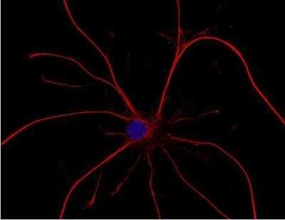 Immunocytochemistry/ Immunofluorescence: VECTASHIELD(R) HardSet(TM) Antifade Mounting Medium with DAPI [H-1500-NB]