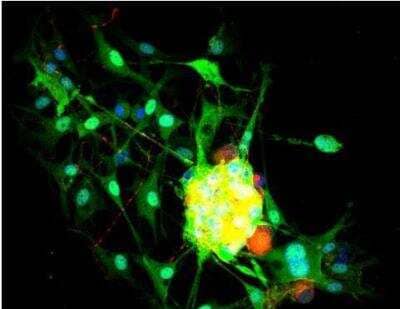 Immunocytochemistry/ Immunofluorescence: VECTASHIELD(R) HardSet(TM) Antifade Mounting Medium with DAPI [H-1500-NB]