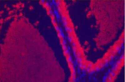Immunohistochemistry: VECTASHIELD(R) HardSet(TM) Antifade Mounting Medium with DAPI [H-1500-NB]
