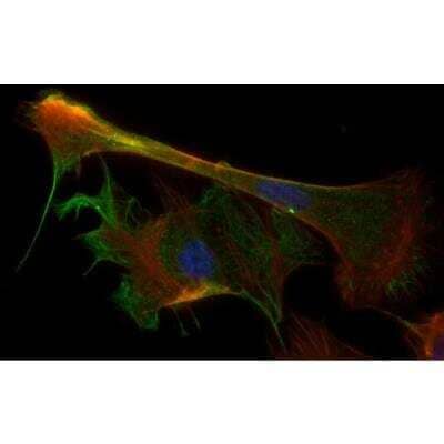 Immunocytochemistry/ Immunofluorescence: VECTASHIELD(R) HardSet(TM) Antifade Mounting Medium with Phalloidin [H-1600-NB]