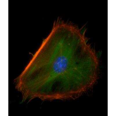 Immunocytochemistry/ Immunofluorescence: VECTASHIELD(R) HardSet(TM) Antifade Mounting Medium with Phalloidin [H-1600-NB]