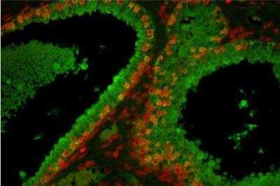 Immunohistochemistry: VECTASHIELD(R) HardSet(TM) Antifade Mounting Medium [H-1400-NB]